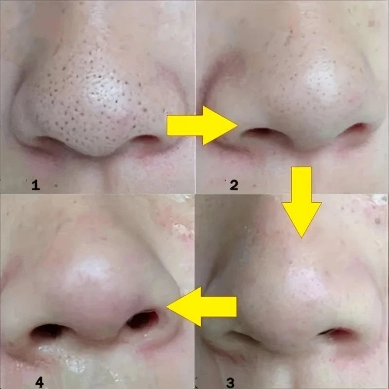 10–50 nose strips for blackhead removal and deep pore cleansing