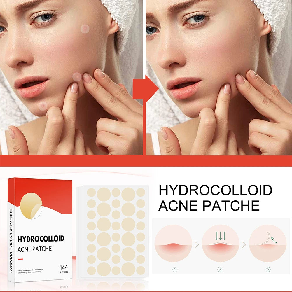 144pcs/set Face Skin Care Acne Pimple Patch 2 Sizes Invisible Professional Healing Absorbing Spot Sticker Covering for Men Women ?
