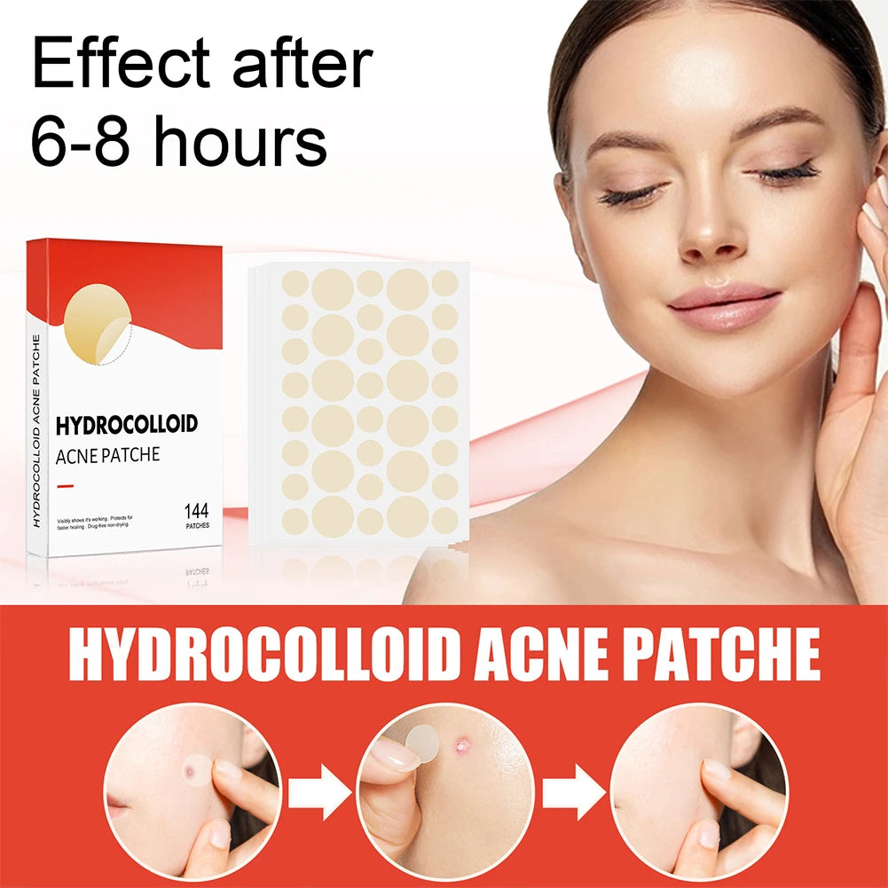 144pcs/set Face Skin Care Acne Pimple Patch 2 Sizes Invisible Professional Healing Absorbing Spot Sticker Covering for Men Women ?