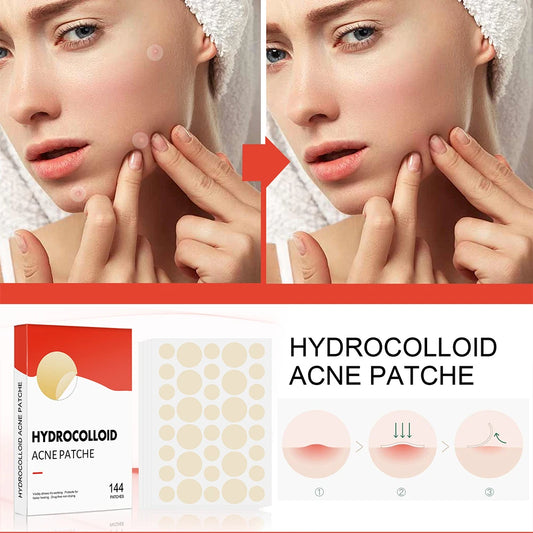 144pcs/set Face Skin Care Acne Pimple Patch 2 Sizes Invisible Professional Healing Absorbing Spot Sticker Covering for Men Women ?