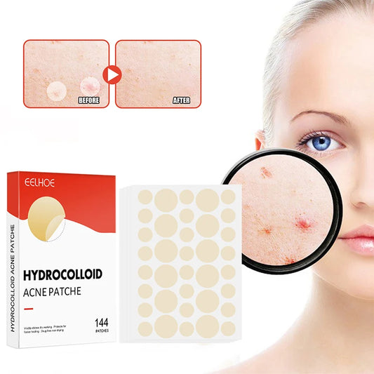 144pcs/set Face Skin Care Acne Pimple Patch 2 Sizes Invisible Professional Healing Absorbing Spot Sticker Covering for Men Women ?