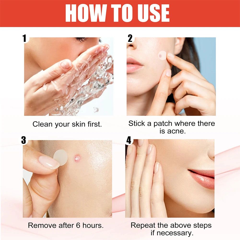 144pcs/set Face Skin Care Acne Pimple Patch 2 Sizes Invisible Professional Healing Absorbing Spot Sticker Covering for Men Women ?